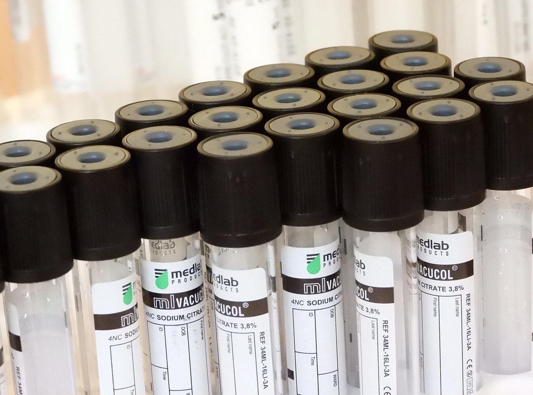 Head-to-Head Analysis